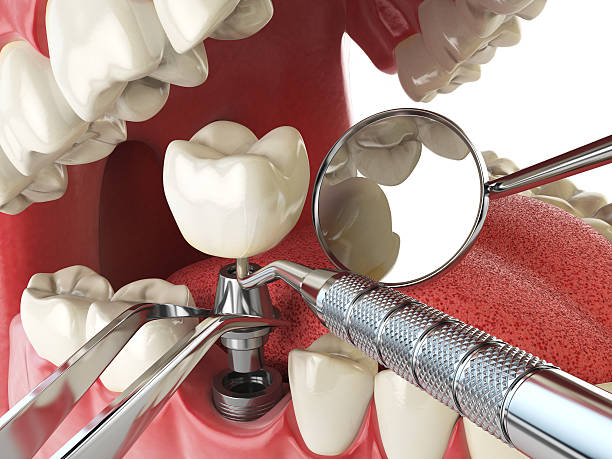 Best Mobile Emergency Dentist in Lake Holiday, IL